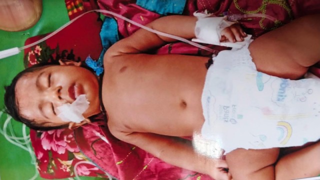 Six-Month-Old Boy Needs Urgent Treatment After Pneumonia, Seizures in Jhalokathi