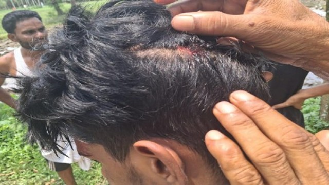 Three Anti-Drug Volunteers Injured in Targeted Attack by Local Gang in Madhabpur