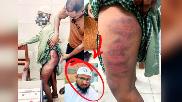 Madrasa Teacher Sent to Jail Over Alleged Torture of Student in Pabna