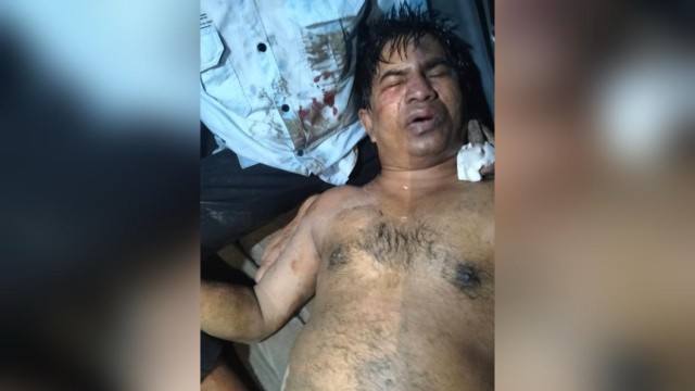 Journalist, Former UP Member Assaulted in Teknaf