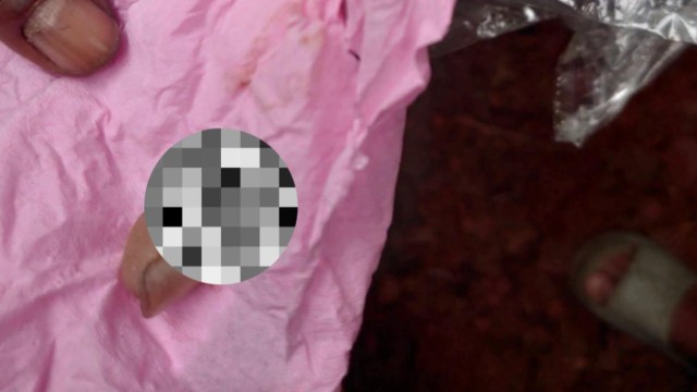 Housewife Bites Off Burglar's Finger During Attempted Break-In in Jhalakathi