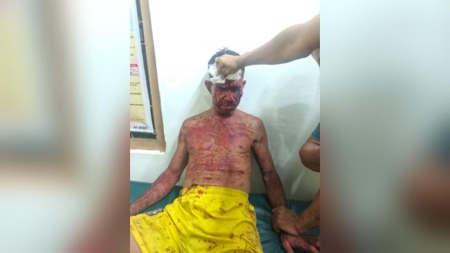 School Guard Allegedly Attacked in Midnight in Rangamati